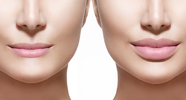 Allure Plastic Surgery Blog | Kim Zolciak-Biermann Shares Her Lip Enhancement with Snapchat